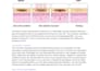 write medical articles with a didactic pattern